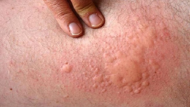 Picture 3 of There is a syndrome that makes us unable to eat onions