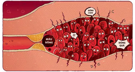 Picture 1 of There was medicine for heart attack and stroke