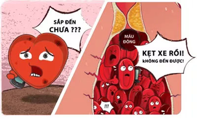 Picture 3 of There was medicine for heart attack and stroke
