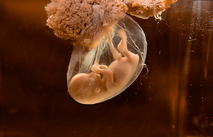 Picture 1 of There will be no babies born prematurely thanks to the new remedy