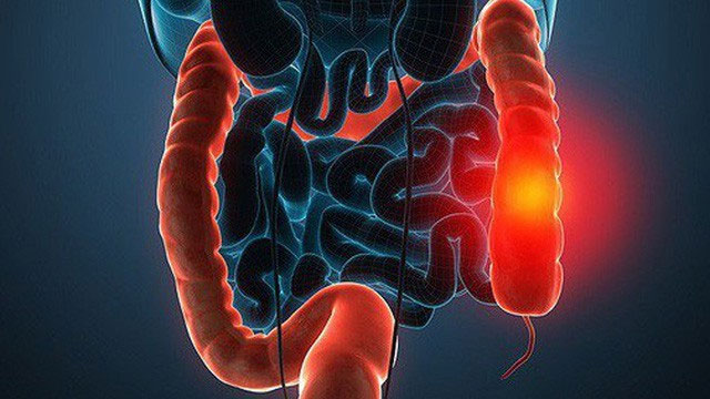 Picture 4 of These types of cancer have a hereditary lifetime that you should know