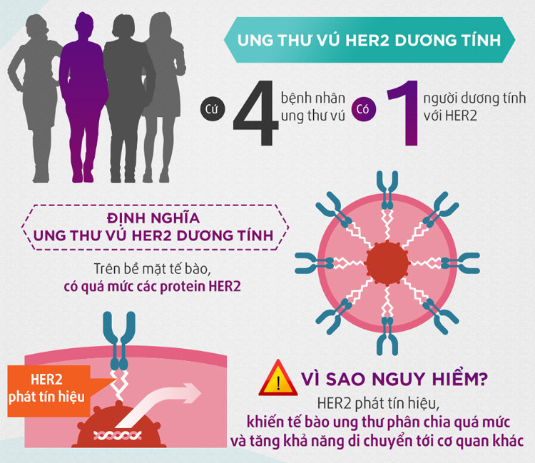 Picture 2 of Things to know about breast cancer when metastasis