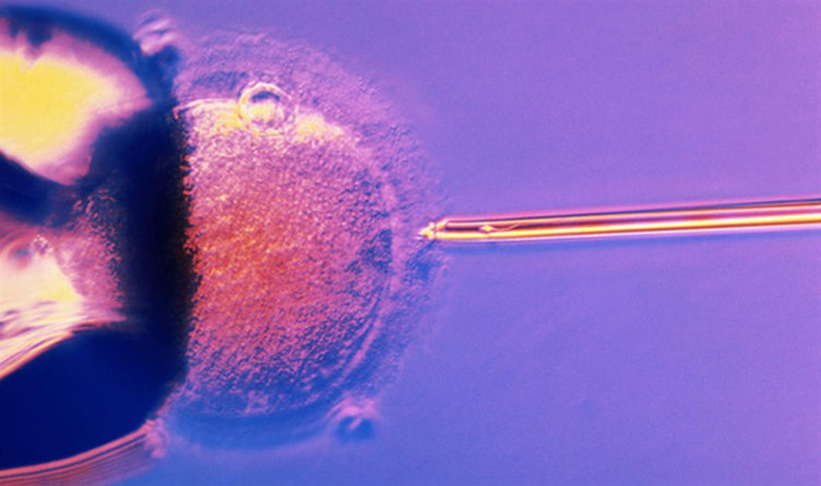 Picture 1 of Things to know about in vitro fertilization