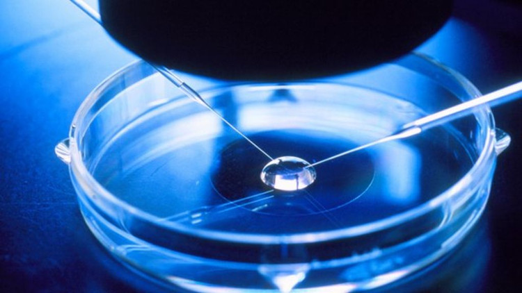 Picture 2 of Things to know about in vitro fertilization