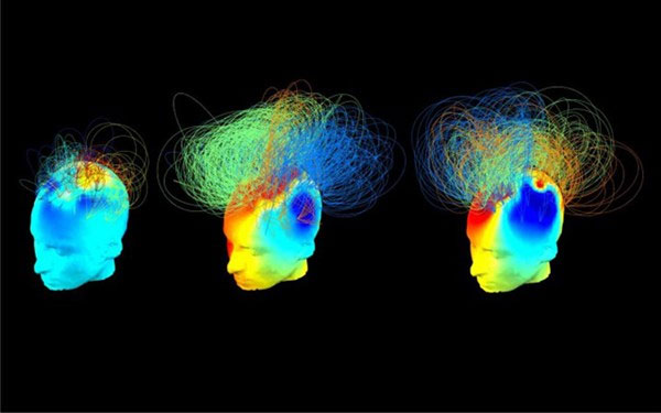 Picture 1 of Thinking device in human brain