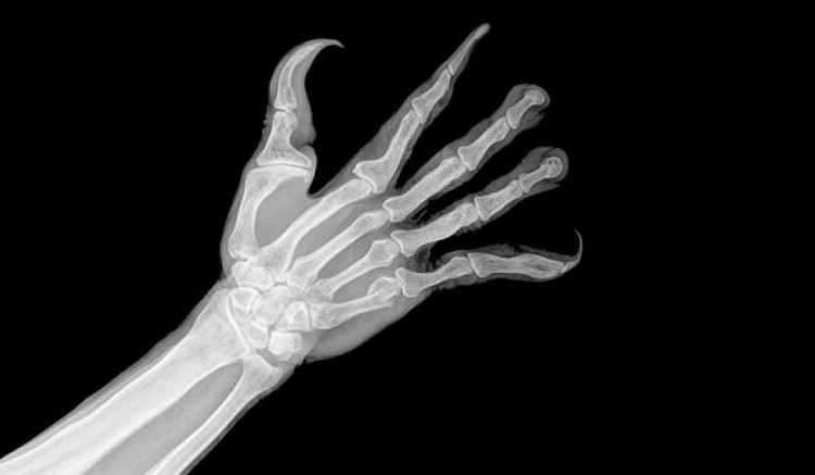 Picture 3 of This is human hands if they are evolved for smartphones