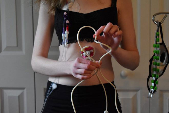 Picture 3 of This is probably the most unfortunate girl because she is allergic to almost everything, from the smell of food, soap to washing powder