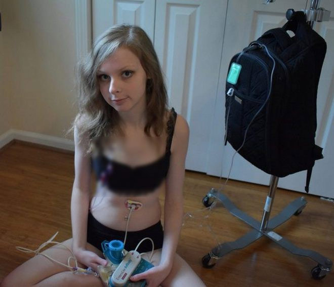 Picture 4 of This is probably the most unfortunate girl because she is allergic to almost everything, from the smell of food, soap to washing powder