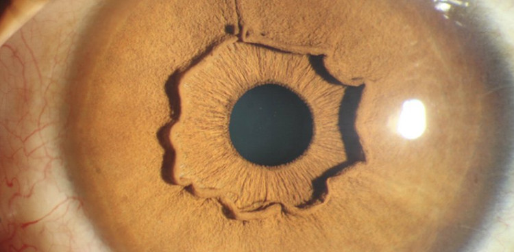 Picture 1 of This is the eyes of a person, but why is this weird?