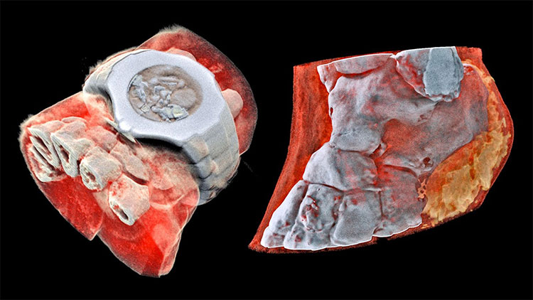 Picture 1 of This is the first 3D color X-ray image in the world, don't see if you're weak at heart