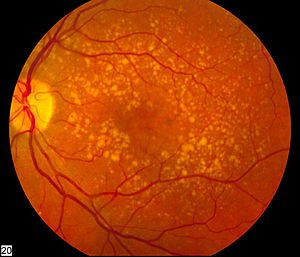 Picture 2 of This is the kind of fruit everyone should eat if they don't want their eyes to be blind when they get old