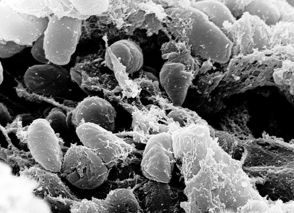 Picture 2 of This seemingly harmless bacterium killed one third of the world's population