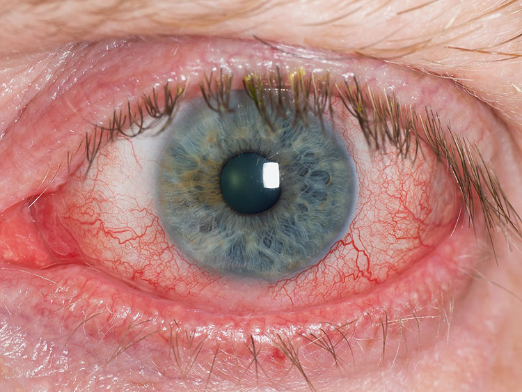 Picture 3 of This terrible harm can make you rethink about using smartphones
