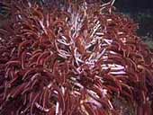 Picture 1 of Thousands of worms in the stomach of a 16-month-old girl