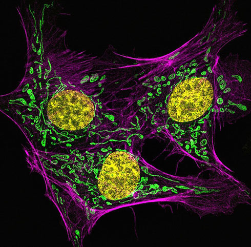 Picture 3 of Through the microscope 2014,