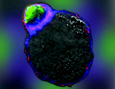 Picture 1 of Tiny 'executioners' in the human body