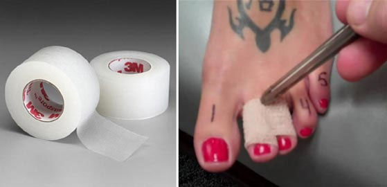 Picture 1 of Tips to help women avoid leg pain when wearing high heels