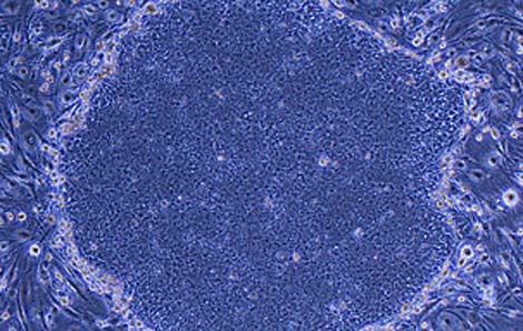 Picture 10 of Top 10 medical breakthroughs in 2010