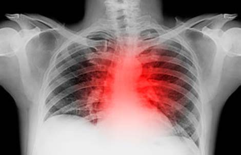 Picture 7 of Top 10 medical breakthroughs in 2010