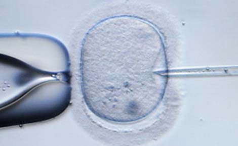 Picture 9 of Top 10 medical breakthroughs in 2010