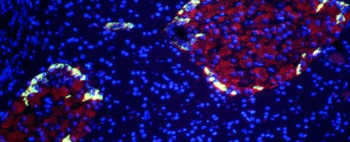 Picture 1 of Transplant human beta cells into mice, cure diabetes