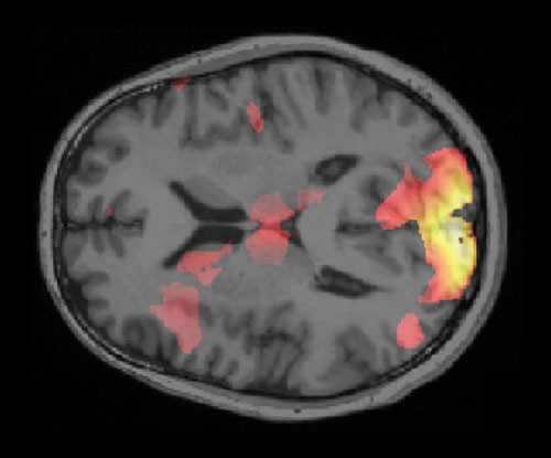 Picture 2 of Treat fear with artificial intelligence