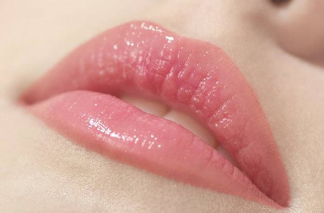Picture 2 of Treating lips cracked