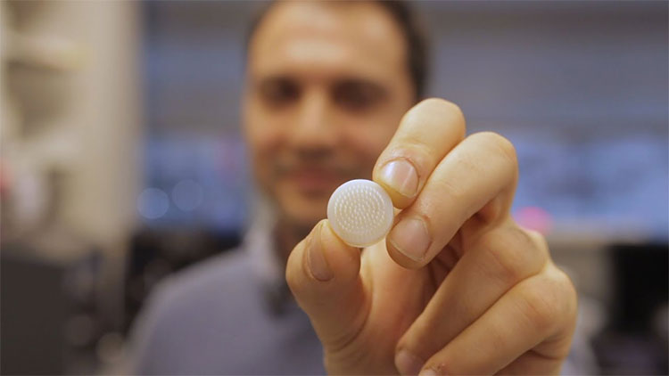 Picture 1 of Treatment of baldness with 3D printing technology