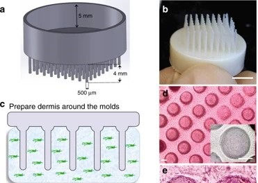 Picture 2 of Treatment of baldness with 3D printing technology
