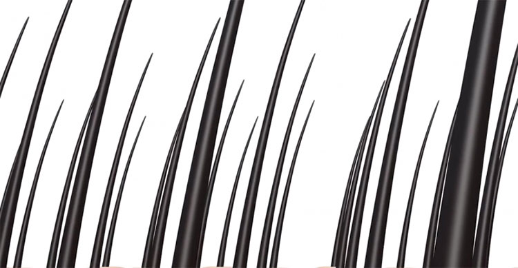 Picture 3 of Treatment of baldness with 3D printing technology