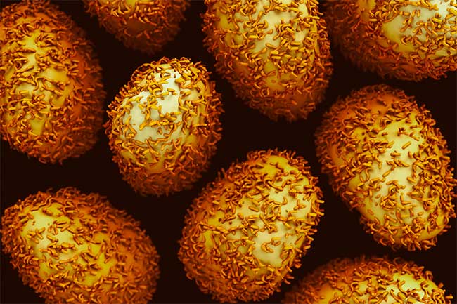 Picture 1 of Treatment of 'edible' cancer cells