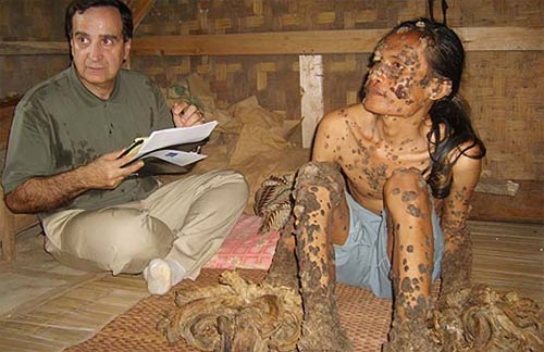 Picture 2 of 'Tree people' in Indonesia