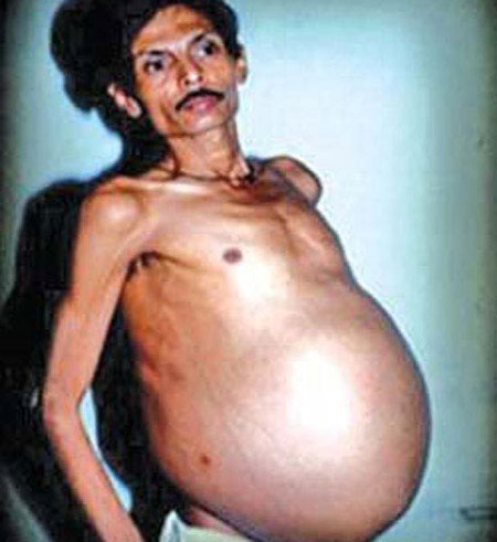 Picture 6 of True stories about twins