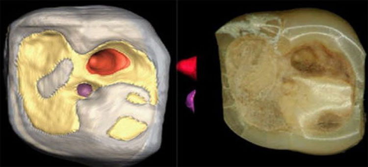 Picture 2 of Unbelievable ways of healing from the Stone Age
