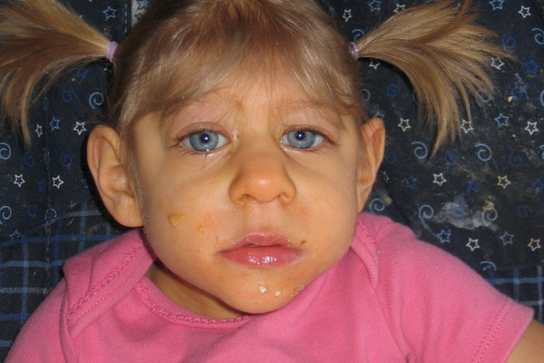 Picture 4 of Understanding the Zika virus 'eating human brain' is especially dangerous