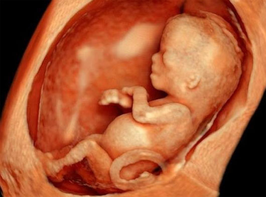 Picture 1 of Unexpected events happen when you are in the womb