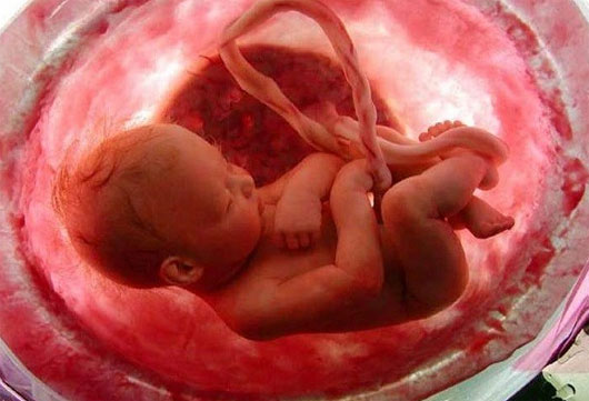Picture 3 of Unexpected events happen when you are in the womb