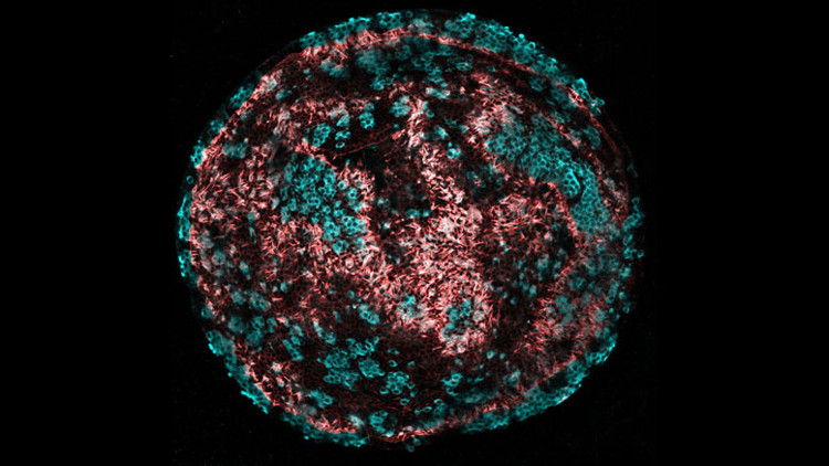 Picture 1 of Unexpected method to help treat hearing loss