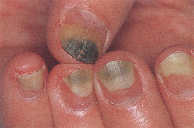 Picture 1 of Unexpected truth hidden under your nails