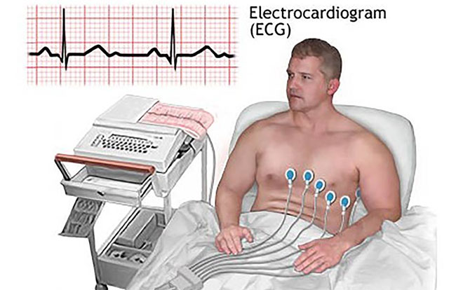 Picture 1 of Unknown things about ECG