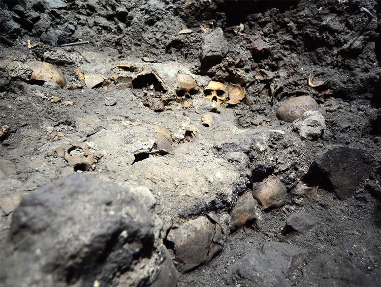Picture 1 of Unprecedented discovery: People know how to treat root canal from the 8th century