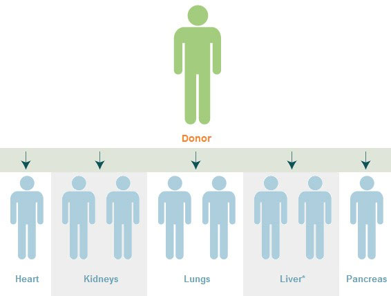 Picture 2 of Unprecedented medical case: 4 people get cancer after receiving transplants from the same person