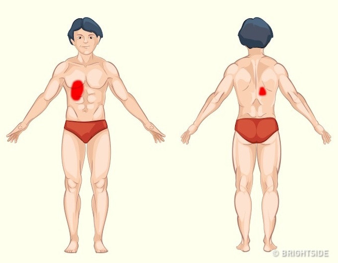 Picture 8 of Unusual pain helps you diagnose yourself