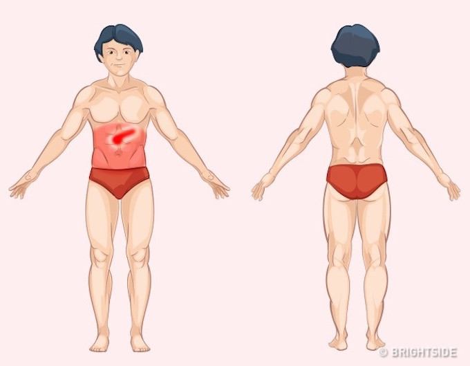 Picture 9 of Unusual pain helps you diagnose yourself