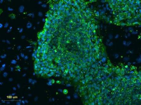 Picture 1 of US launches clinical trial of stem cell therapy