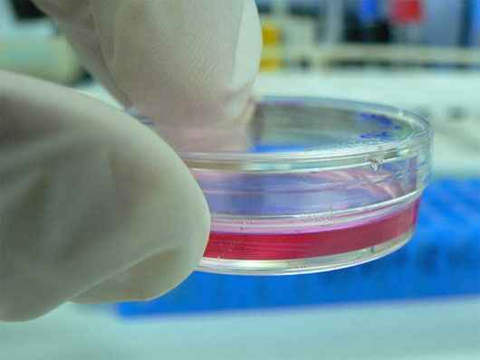 Picture 1 of Use amniotic sac tissue to protect and cultivate damaged cornea