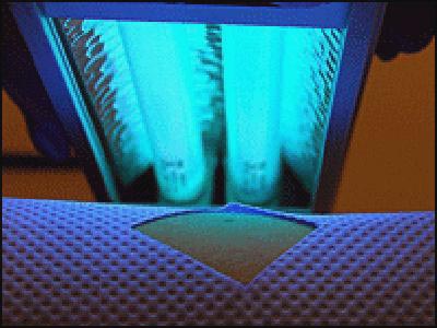 Picture 2 of Use ultraviolet rays for cancer treatment