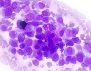 Picture 2 of Using molecules as a sign of biological identification on stem cells: supporting treatment methods.