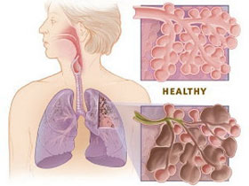Picture 1 of Using stem cells to cure obstructive pulmonary disease