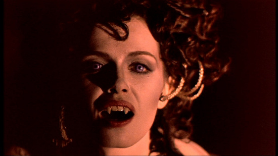 Picture 1 of Vampire syndrome